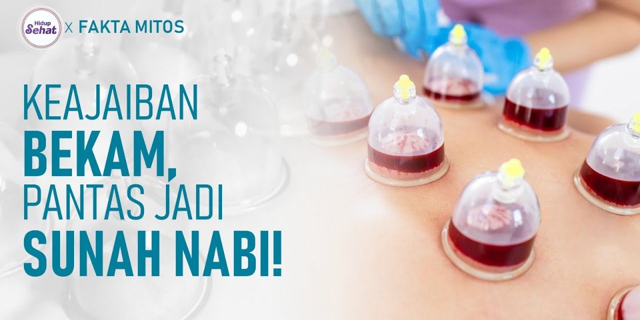 Pengobatan Islam Hijamah Di Sunahkan Nabi Muhammad SAW