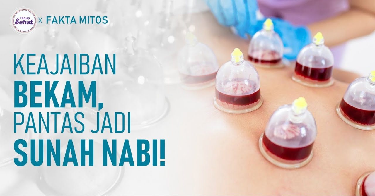 Pengobatan Islam Hijamah Di Sunahkan Nabi Muhammad SAW